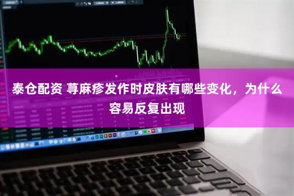 泰仓配资 荨麻疹发作时皮肤有哪些变化，为什么容易反复出现